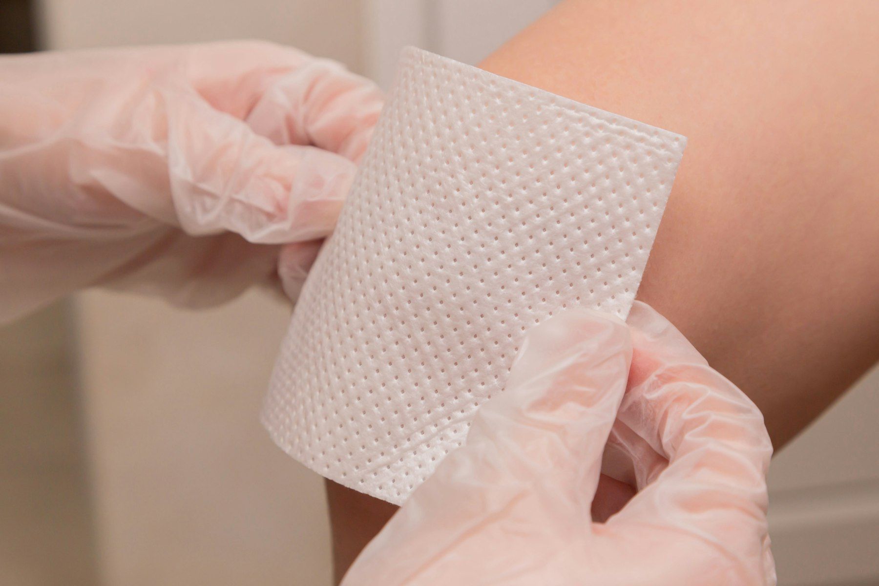 Gloved hands place a gauze dressing on a patient’s arm
